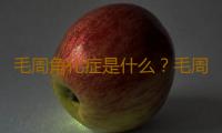 毛周角化症是什么？毛周角化症的症状